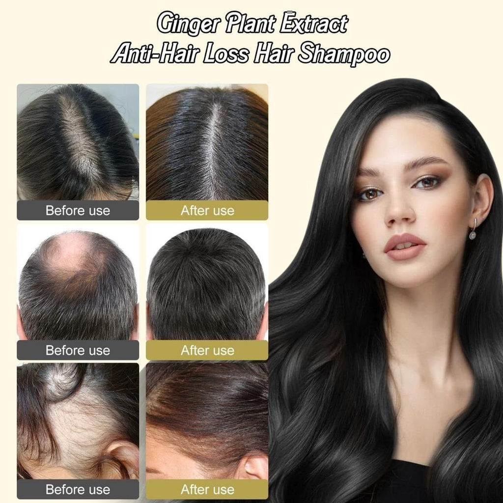 Anti-Hair Loss Hair Shampoo 600 ml ( Buy 1 Get 2 Free )