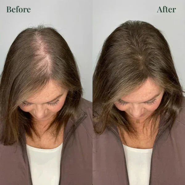 𝐊𝐞𝐫𝐚𝐫𝐨𝐬𝐞 𝐑𝐨𝐬𝐞𝐦𝐚𝐫𝐲 𝐒𝐡𝐚𝐦𝐩𝐨𝐨 𝐅𝐨𝐫 𝐇𝐚𝐢𝐫 𝐆𝐫𝐨𝐰𝐭𝐡 ( 𝐁𝐮𝐲 𝟏 𝐆𝐞𝐭 𝟏 𝐅𝐫𝐞𝐞 🔥)