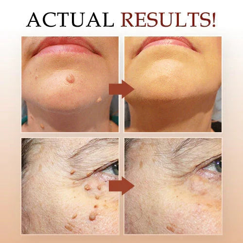 𝐋𝐎𝐕𝐈𝐋𝐃𝐒™ 𝐓𝐚𝐠𝐬 & 𝐌𝐨𝐥𝐞𝐬 𝐑𝐞𝐦𝐨𝐯𝐞𝐫 ( 𝐁𝐮𝐲 𝟏 𝐆𝐞𝐭 𝟏 𝐅𝐫𝐞𝐞🔥🔥) 𝐒𝐚𝐯𝐞 𝐑𝐬. 𝟗𝟎𝟎.𝟎𝟎
